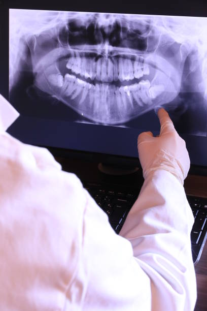 Best Same-Day Emergency Dentist in Lake Shore, WA