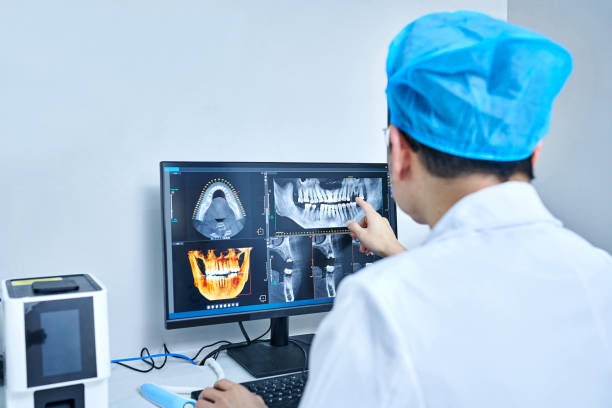 Best Emergency Broken Tooth Repair in Lake Shore, WA